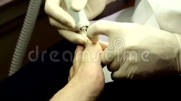 皮肤科医生与病人指甲合作视频的预览图