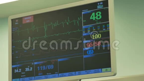 手术室心电监护仪视频的预览图
