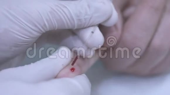 采集血样希夫检测采血手指血液测试视频的预览图