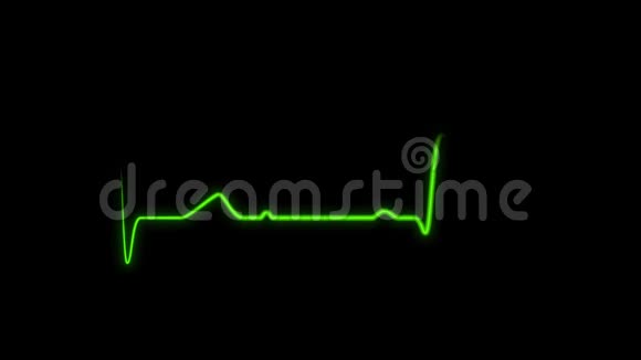 心电图心电信号心跳波脉搏节奏视频的预览图