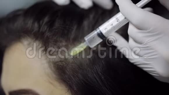 治疗头皮发头部的中间疗法特写视频的预览图