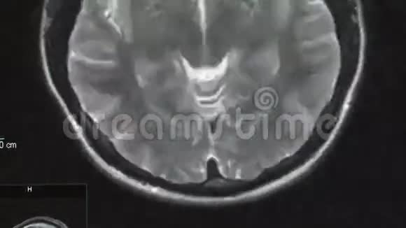 X射线计算机断层扫描视频的预览图