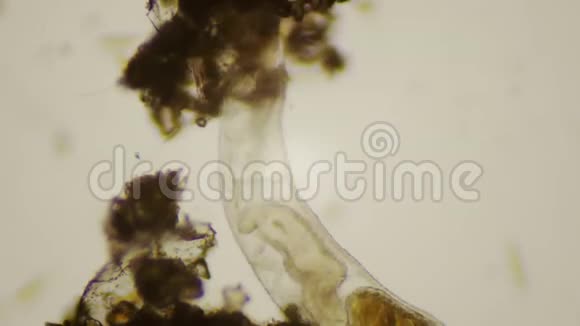 显微镜下的Nematode在4k视频的预览图