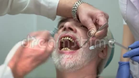 口腔学家抛光牙齿视频的预览图