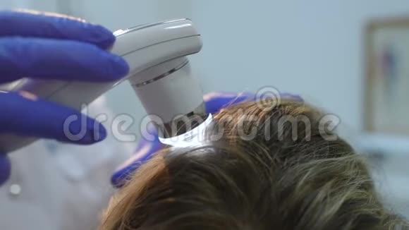 旋毛镜是检查头发的一种方法视频的预览图