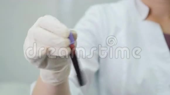 医生手里拿着一根带血的管子视频的预览图