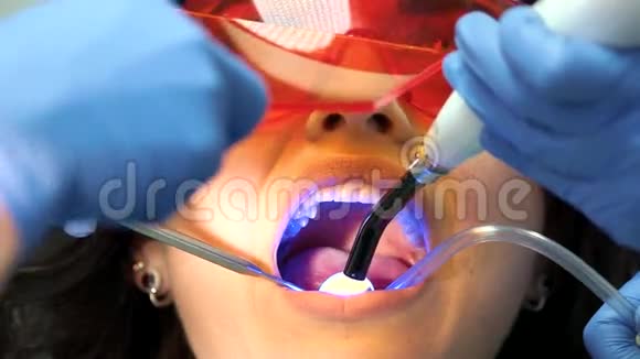 牙医使用的是固化光视频的预览图