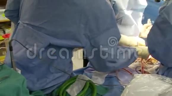 脊柱手术15例中的12例视频的预览图