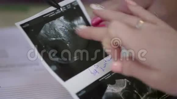人胚胎医学超声扫描视频的预览图