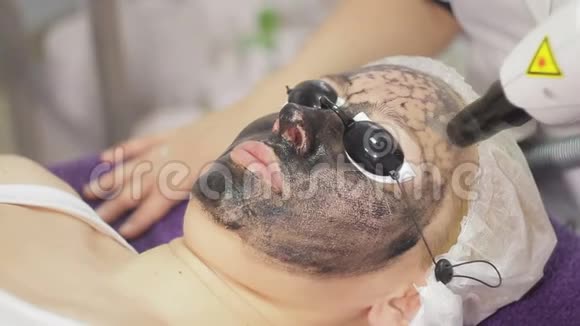 碳面剥离工序激光脉冲清洁面部皮肤硬件美容治疗程序视频的预览图
