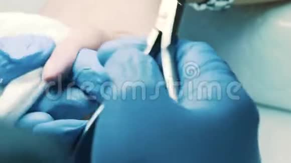 美容院美容师用指甲钳切掉顾客手指上多余的皮肤视频的预览图