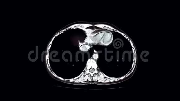 腹腔胃肠道膀胱的MRI对比视频的预览图