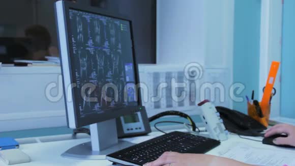 医生在医院看CT扫描视频的预览图