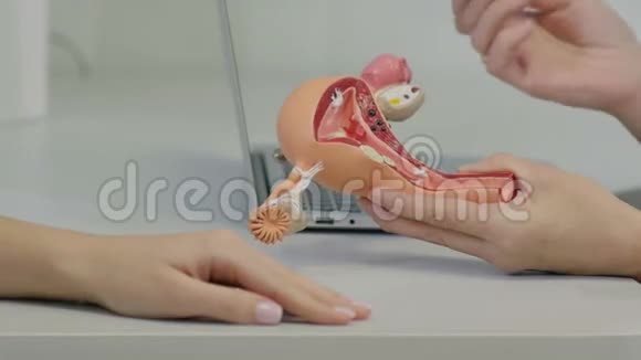 妇科医生会诊病人子宫解剖模型视频的预览图