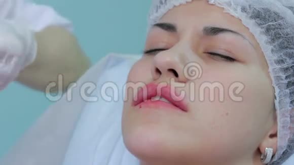 唇注射整形手术下唇视频的预览图