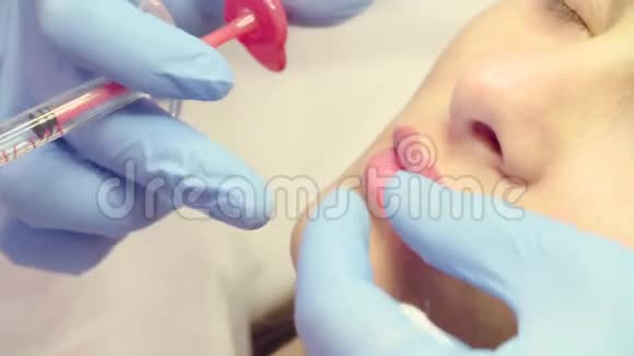 隆唇期间病人的面部视频的预览图