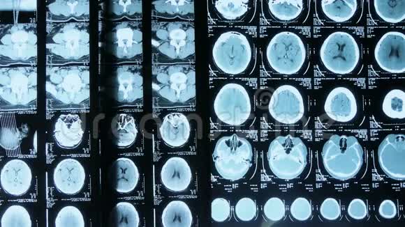医生研究颅脑X线片进行分析视频的预览图
