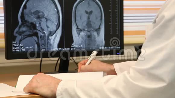 医生书写脑扫描医学处方视频的预览图