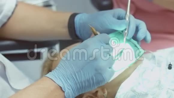 在牙科诊所做手术的女人牙医带着助理把牙印视频的预览图