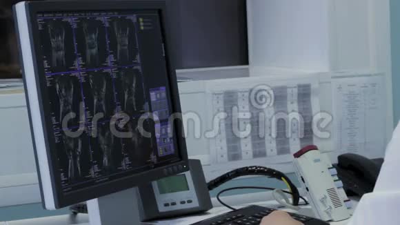 医生用X光在电脑上工作视频的预览图