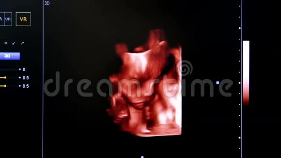 彩色超声监测图像四房宝宝心景视频的预览图