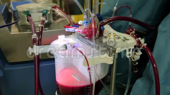 一个功能正常的心脏肺动机的特写镜头里面有大量的血液视频的预览图
