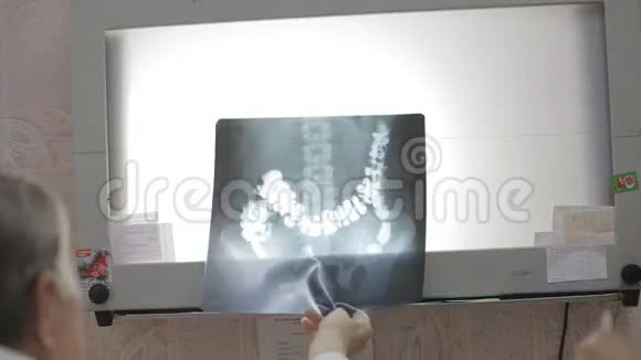 医生讨论病人的x射线图像视频的预览图