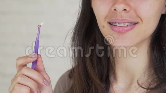 牙套的口腔卫生戴牙套的年轻女孩清洁牙齿少女清洁和刷牙视频的预览图