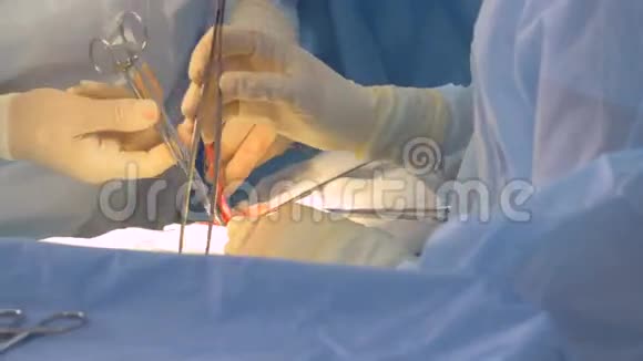 外科医生团队动手做手术快关门视频的预览图