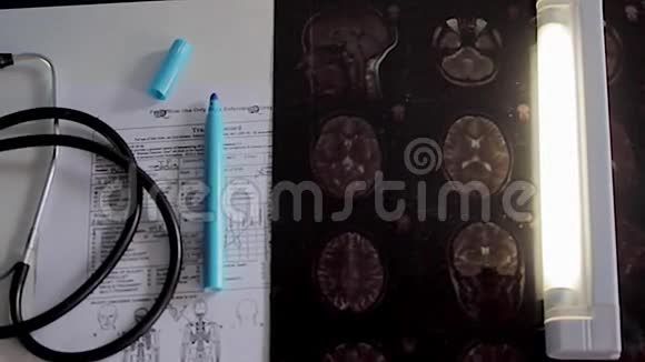 医学诊断x线和听诊器视频的预览图