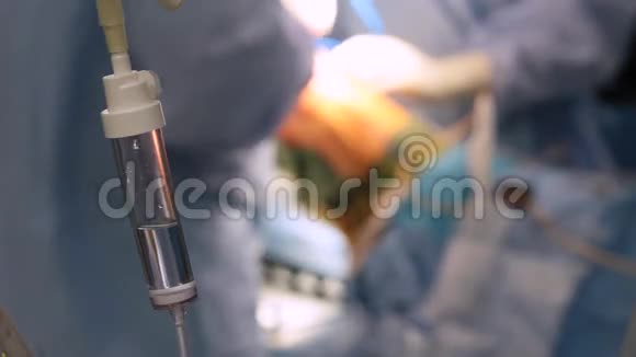 膝关节外科手术1例视频的预览图