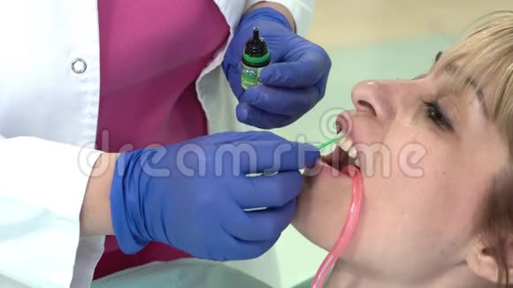 牙医为放置牙科贴面提供基础视频的预览图