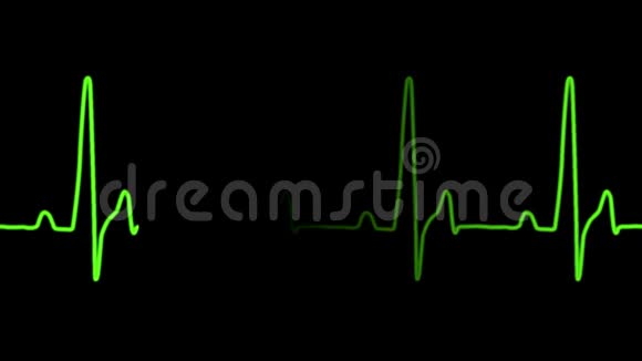 心电图心电图心电图心电图及人体心跳声运动图视频的预览图