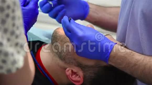 牙医移除牙齿视频的预览图