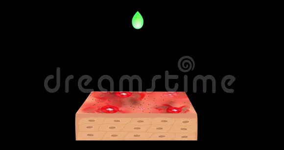 动画视频治疗痤疮皮肤酸剥落是滴在皮肤上的一滴解剖结构视频的预览图