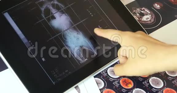 4k医生在ipad上研究MRI扫描仪头和器官宠物ct视频的预览图