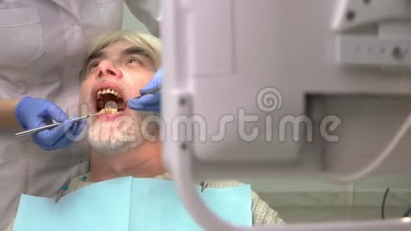 牙医带镜子检查病人视频的预览图