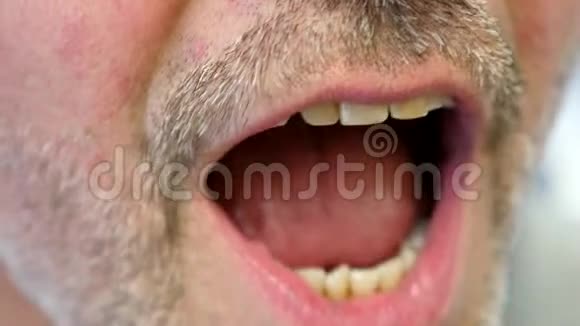 合上病人嘴和牙医检查牙齿的录像视频的预览图
