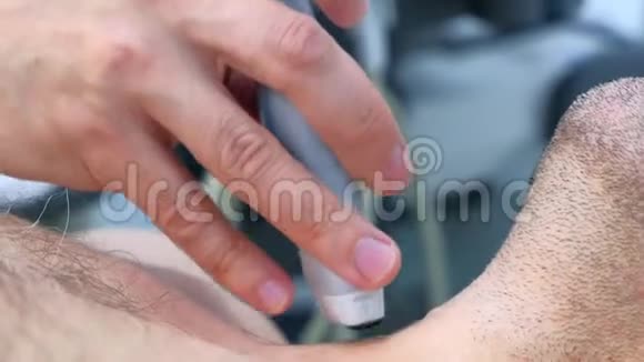 男性患者用超声扫描仪检查甲状腺特写视频的预览图