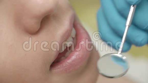 口腔和牙齿的检查在口腔检查过程中病人年轻女孩张开嘴的特写视频的预览图