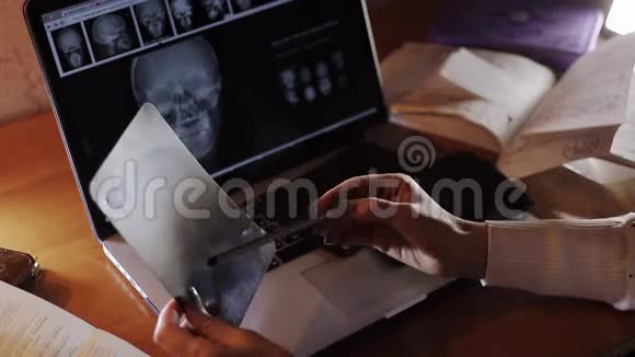 医生用笔记本电脑看着晚上的X光视频的预览图