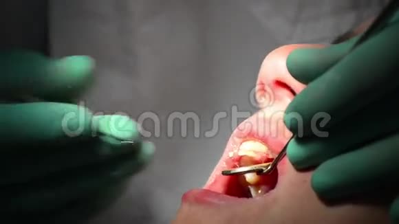 牙医修理女孩的牙齿视频的预览图