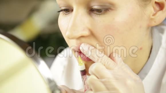 美容师用透明质酸填充剂进行唇注射视频的预览图