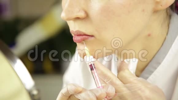 唇注射整形手术美容师自己做脂肪增强视频的预览图