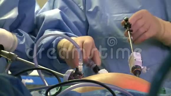 腹腔镜手术中的手工作910视频的预览图