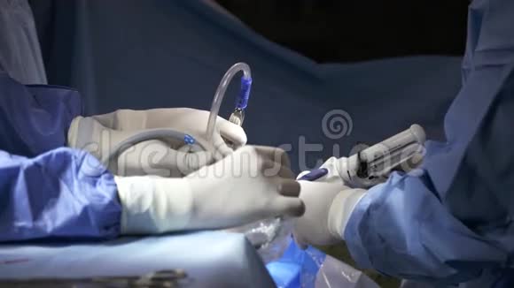 外科医生准备腹腔镜肺手术视频的预览图