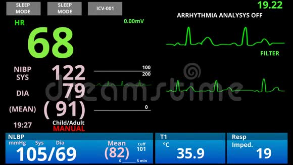 病人死亡脉搏下降医学生命体征监测心脏传感器诊断视频的预览图