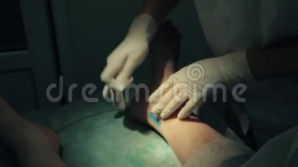医生术后涂胶膏药视频的预览图