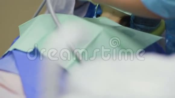 牙科用特殊设备操作女性病人的牙齿视频的预览图