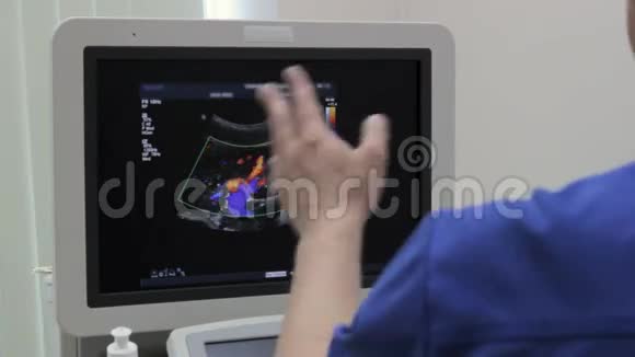 医生在监视器上显示超声检查树色血管和肾动脉视频的预览图